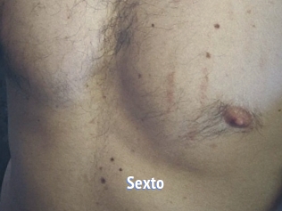 sexto Telefon Kontakte