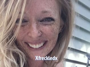 Xfreckledx